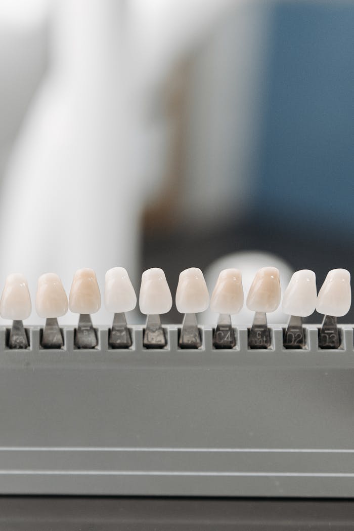 Close-up display of dental veneer samples in a holder, ideal for dentistry.